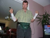 Random family photos a hole in the arm antibiotics